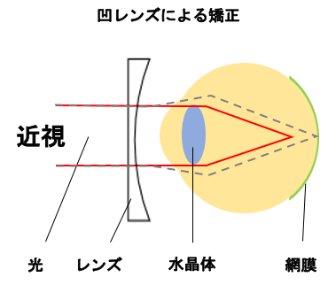 眼球図 目の仕組み 近視 遠視 凹レンズ 凸レンズ メガネ megane
